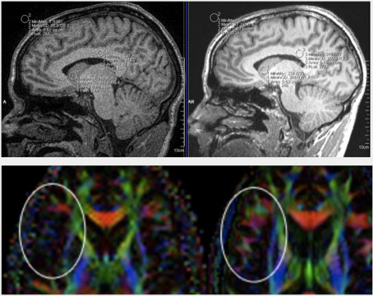Digital images of scans of the brain