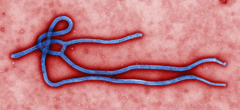 Microscopic view of Ebola virus viron