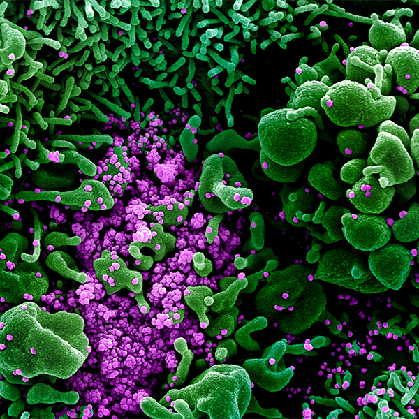 Color-enhanced scanning electron microscope image 