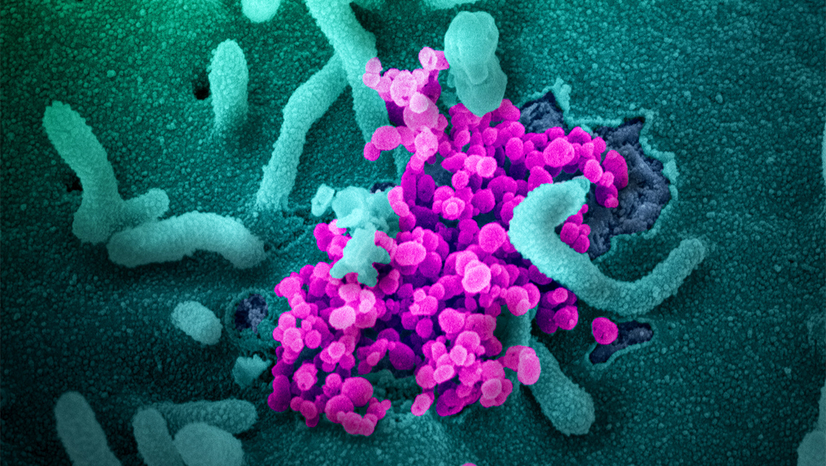 Scanning electron microscope image colorized in green and pink