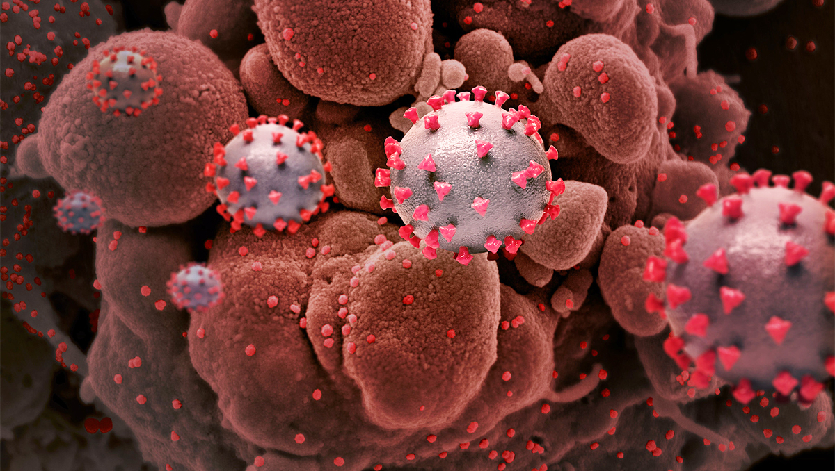 A photoillustration of the SARS-CoV-2 virus particles superimposed on images of cells taken via microscope