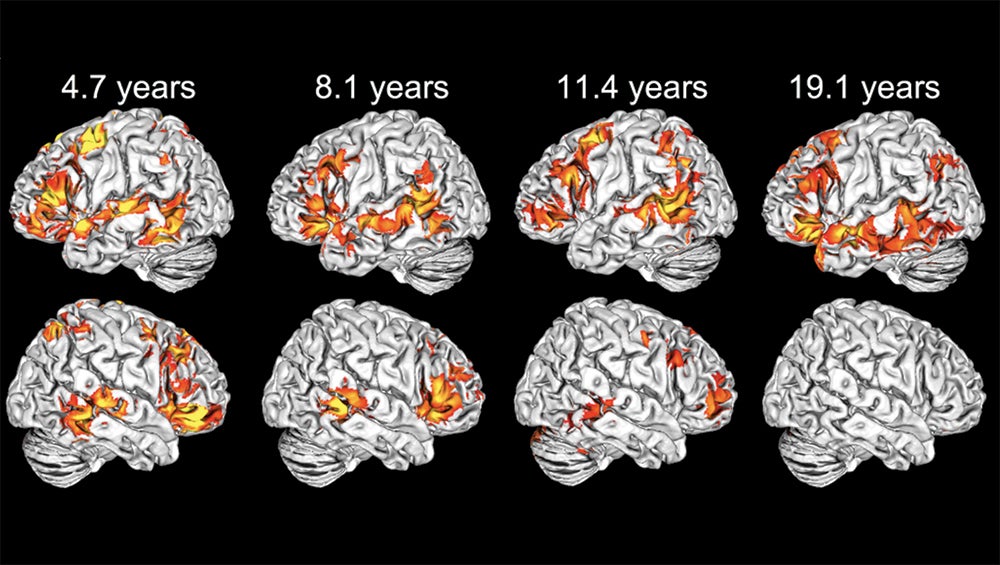 Composite image showing brain scans that display language processing activation at different ages in red