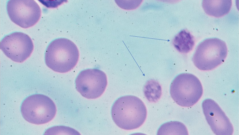 A photo-microscopic view of bone marrow platelets