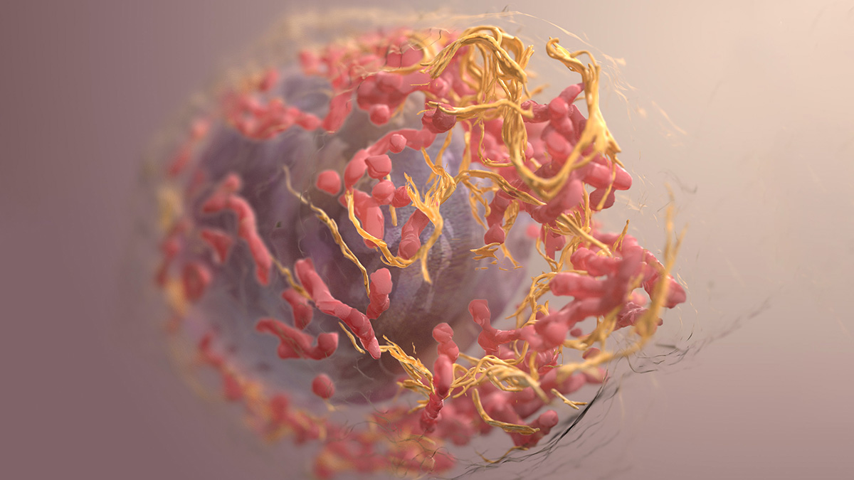 Illustration of a melanoma cell