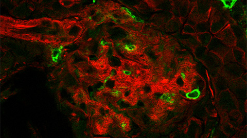 Immunofluorescence image in reds and greens
