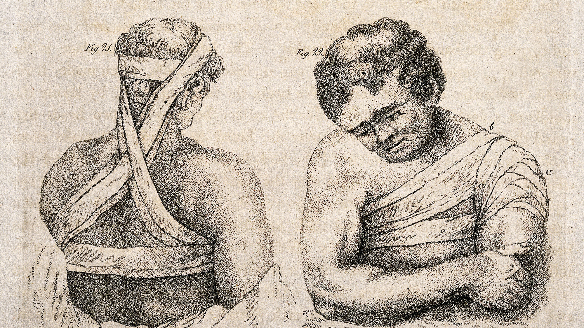 An historical illustration depicts bandaging technique