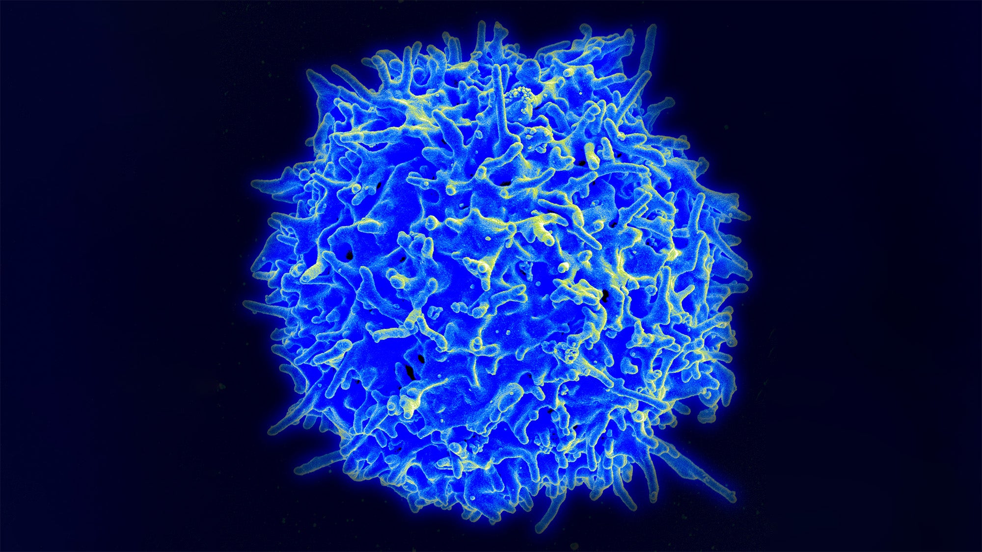 A photomicrograph of a health human T cell rendered in blue