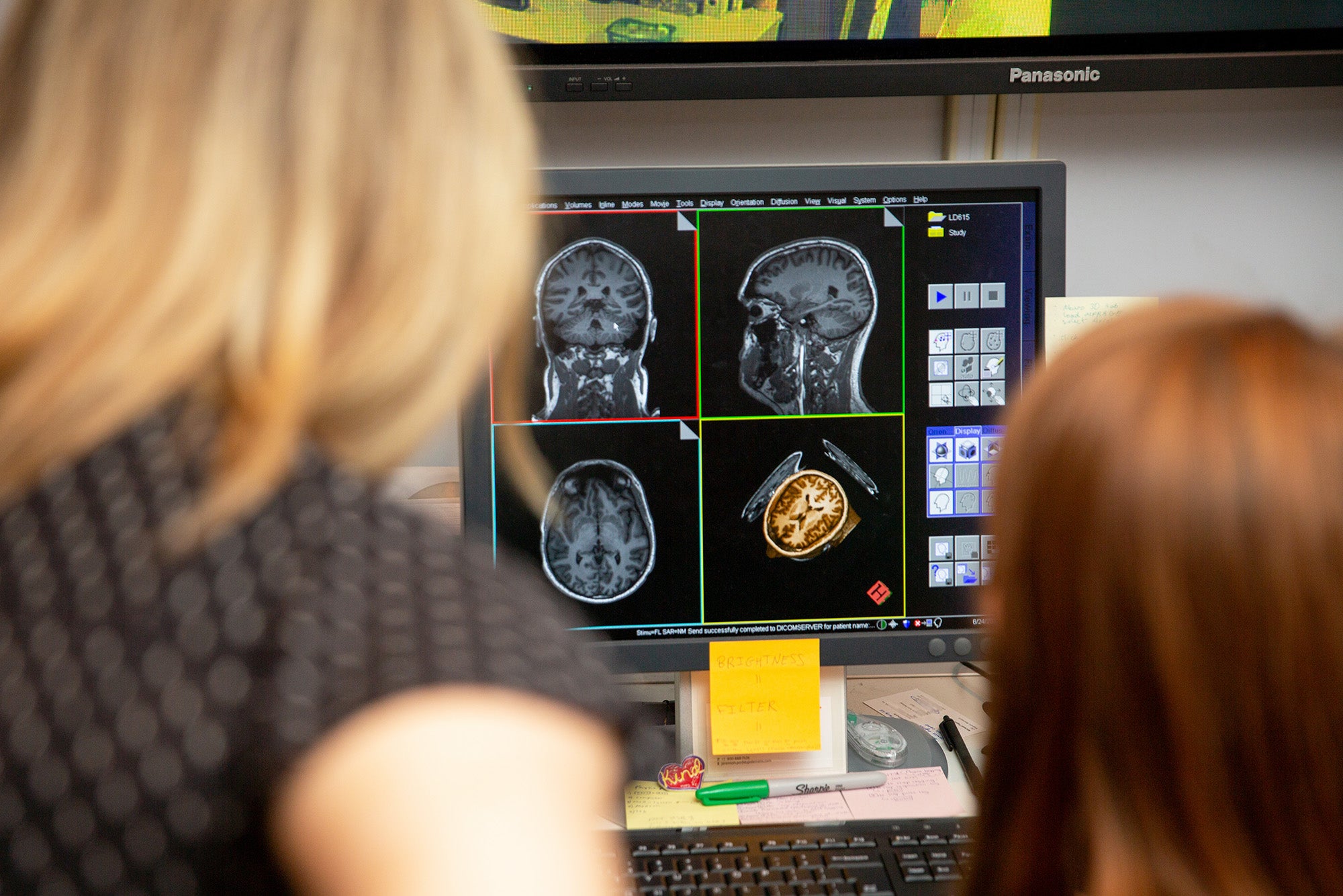 Two individuals look at a computer screen on which a brain scan appears