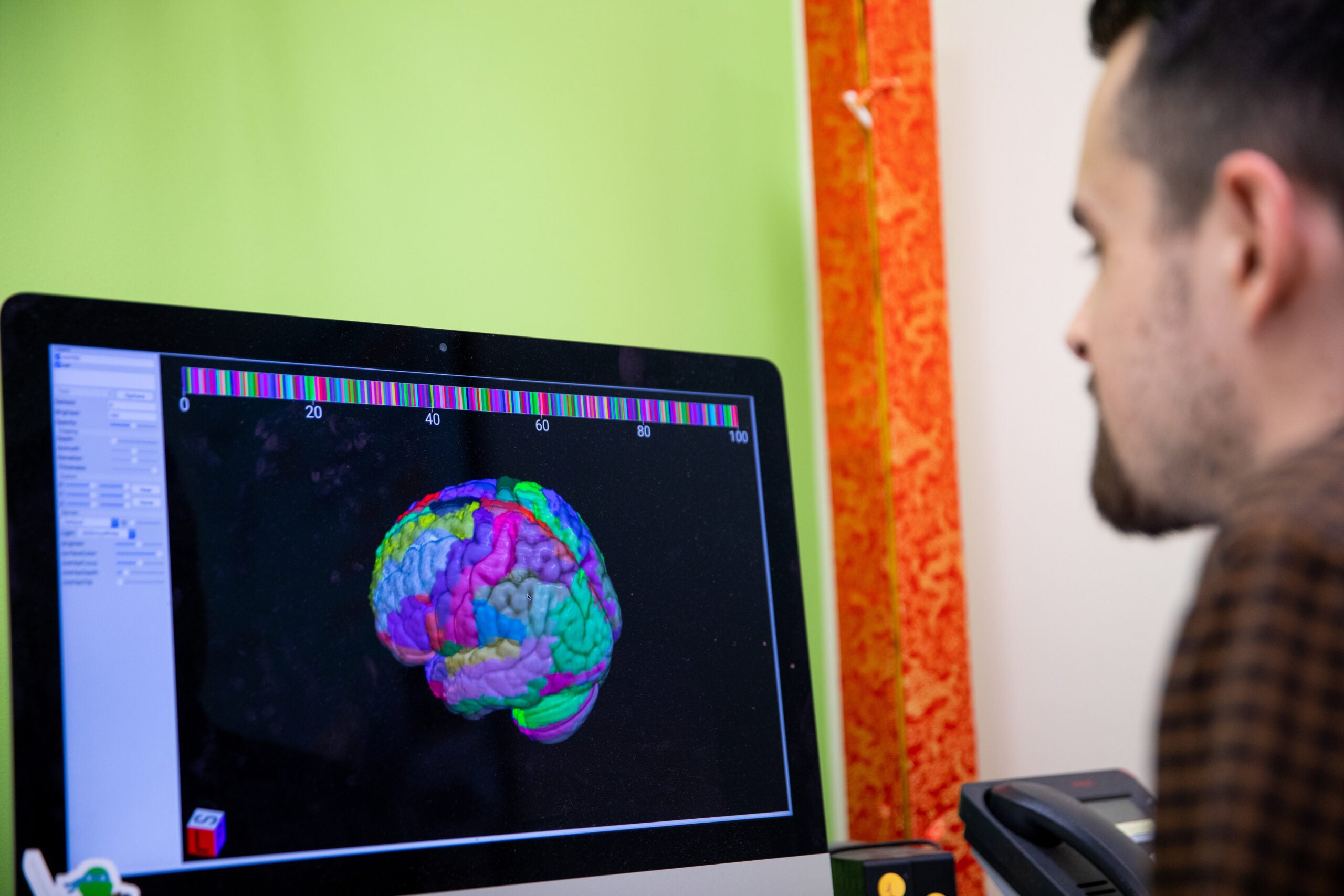 A researcher looks at the image of a brain on a computer screen
